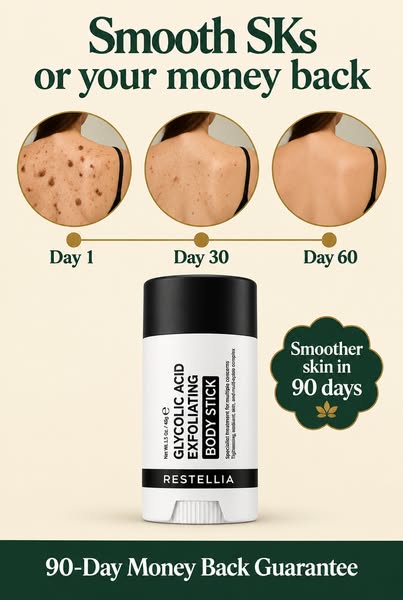 Finally Get Ahead Of Your Seborrheic Keratoses
