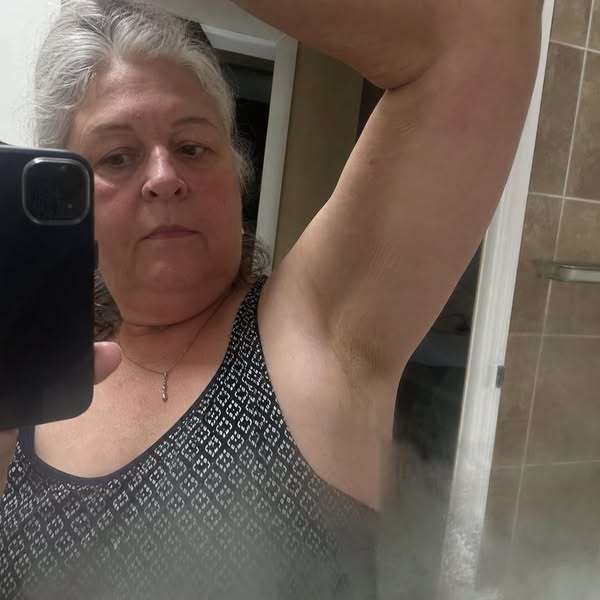 La vraie cause du relâchement après la ménopause n'est pas musculaire