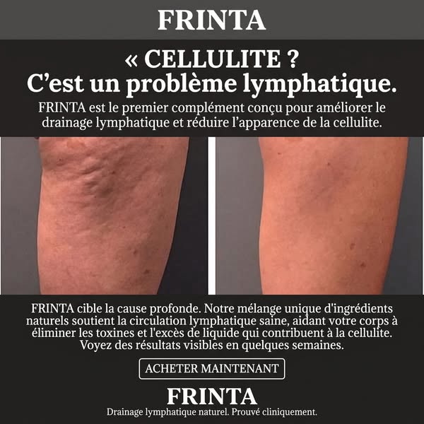Mince et de la cellulite ?