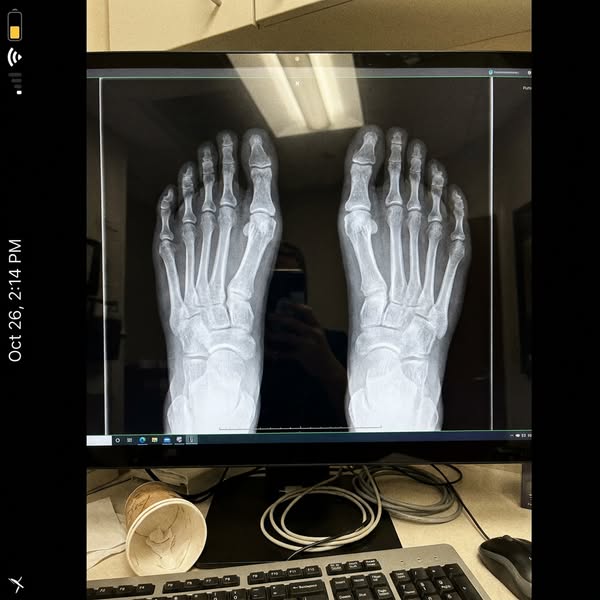 Fix Neuropathy Naturally