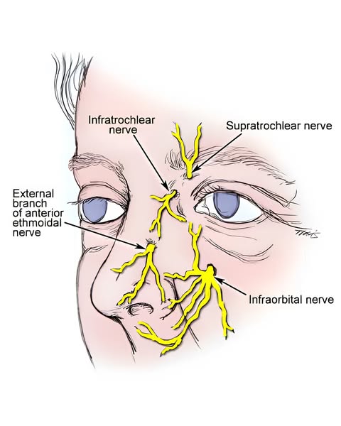 There Is A Nerve Branch Running Through Your Cheekbones. I Had 'Sinus Pressure' For Eleven Years Before I Knew Its Name.