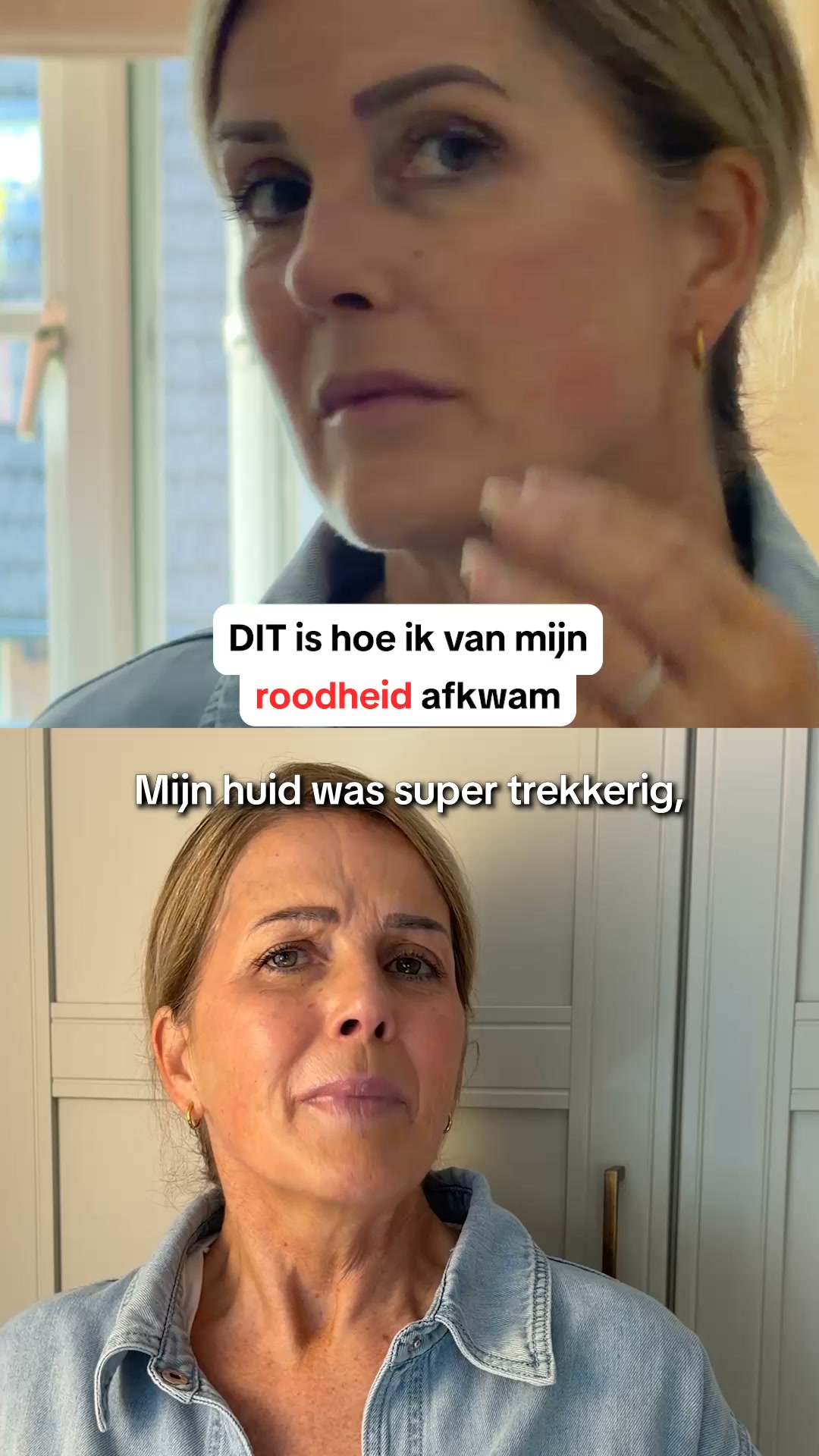 Je huid verdient meer dan hydratatie