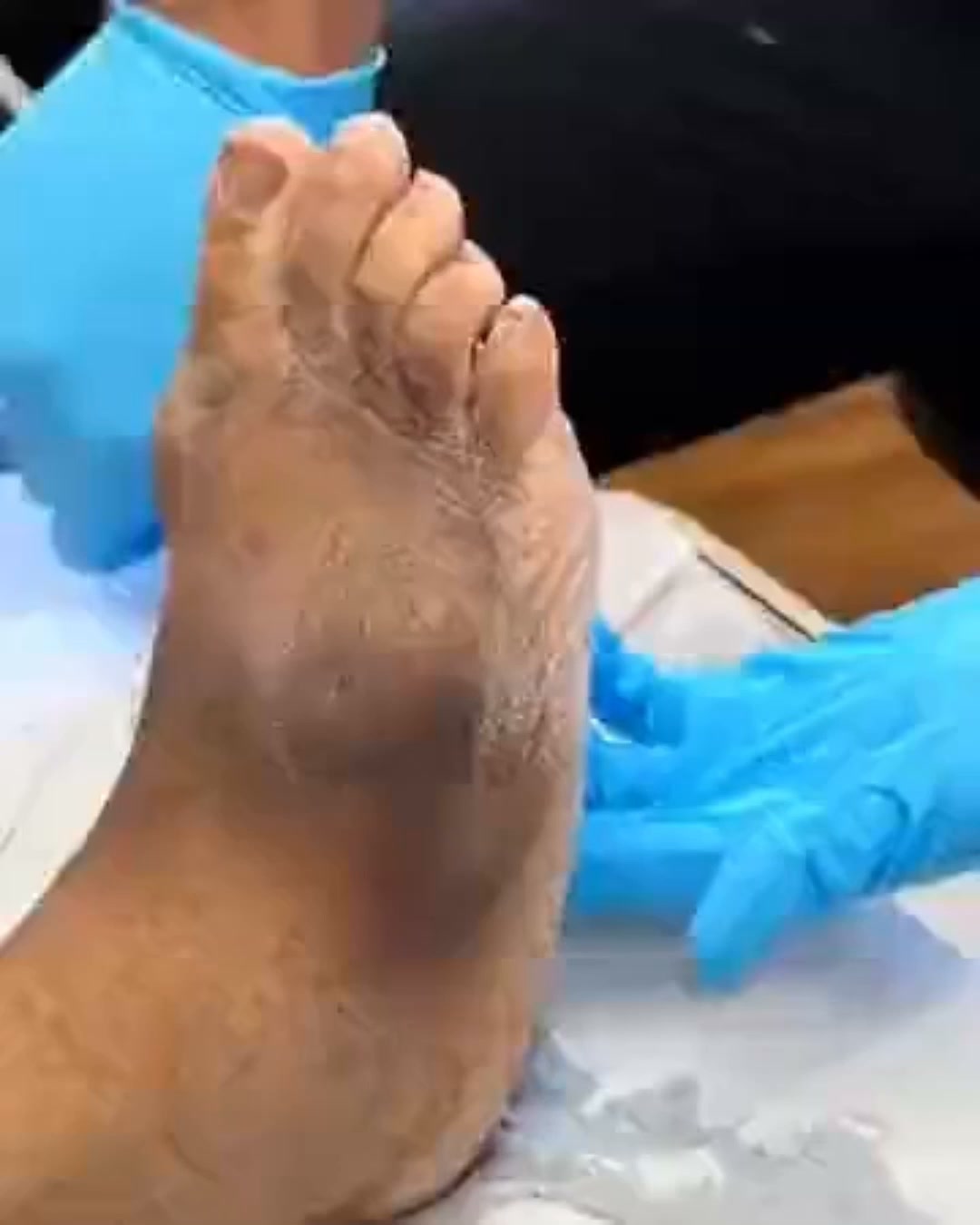 ¡Acaba con el dolor neuropático de una vez por todas!