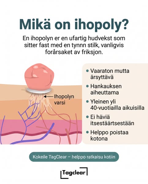 Tiedätkö mikä ihopoly oikeasti on?