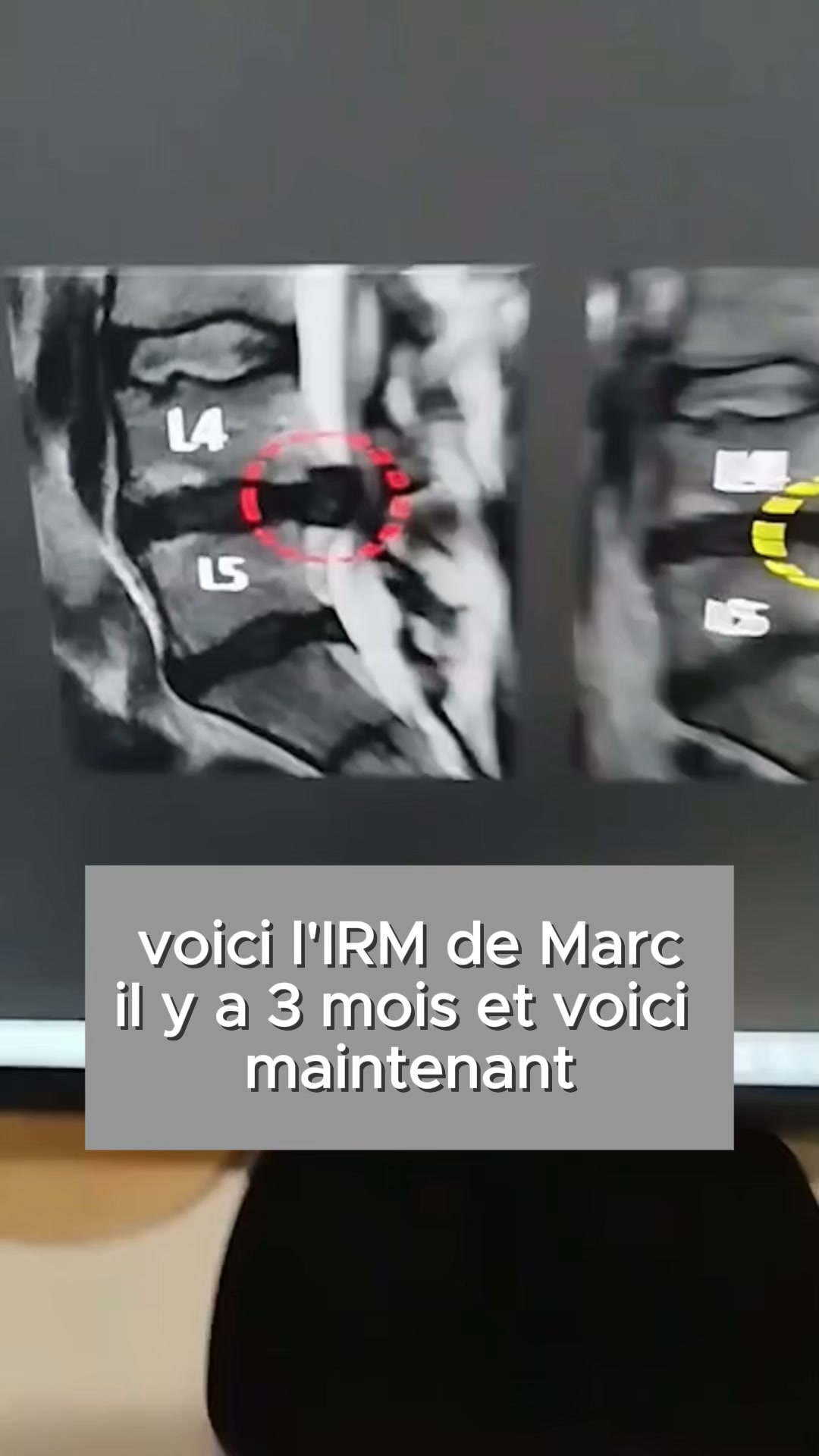 3 méthodes pour soulager les douleurs dorsales