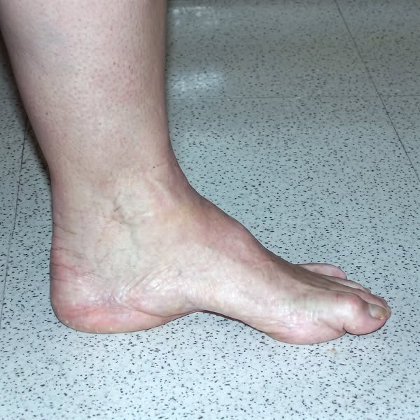 Foot Pain? Read This.