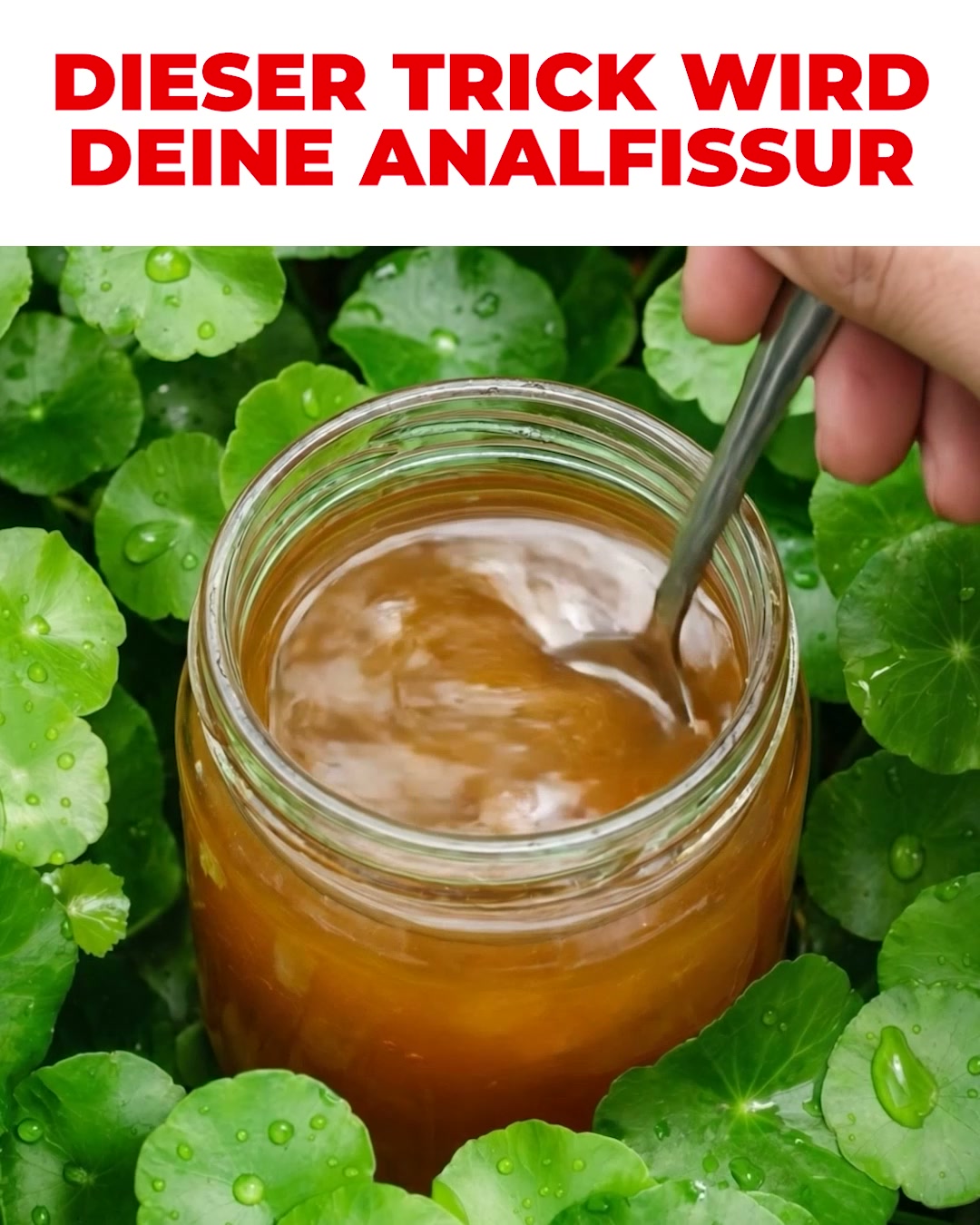 Proktologin erklärt: Warum Hämorrhoiden immer wieder zurückkommen