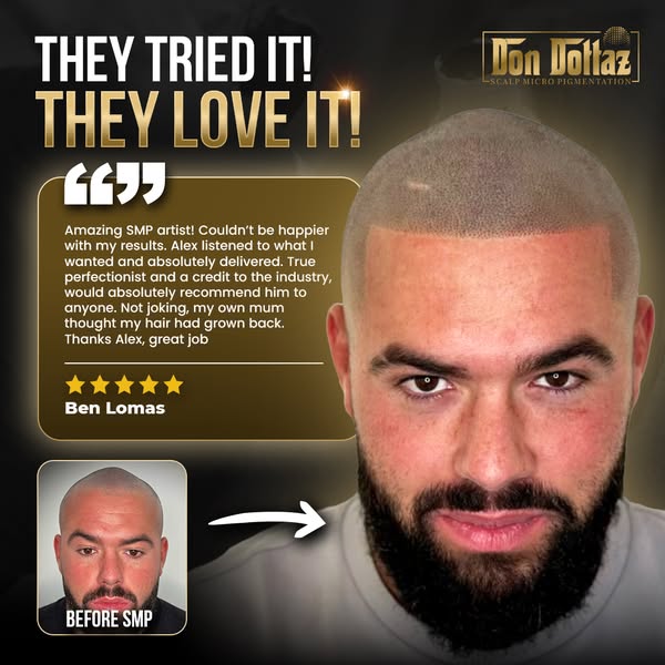 England – Fight Back Against Hair Loss