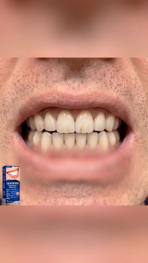 Focused Nighttime Care for the Gumline