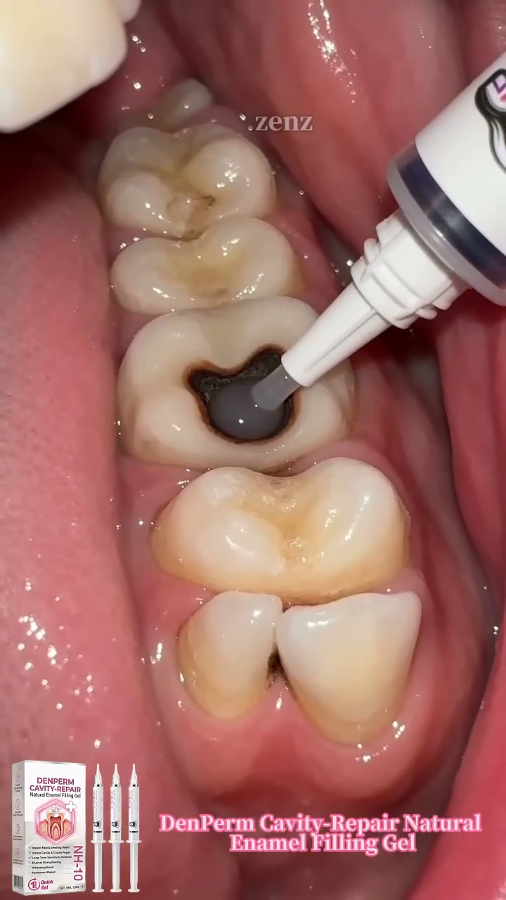 Cavity Repair FDA-Recognized 10% Nano-Hydroxyapatite (NH-10) | Delivery within 2-4 working days | Full refund guarantee