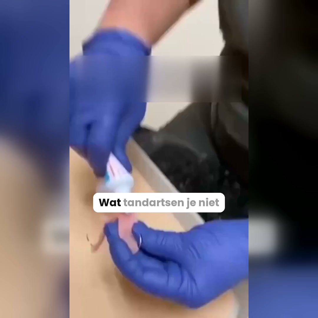 Nooit meer bang dat je kunstgebit verschuift