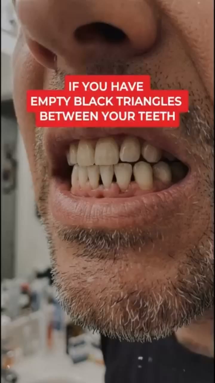Nourish Your Gums, Reveal Your Smile