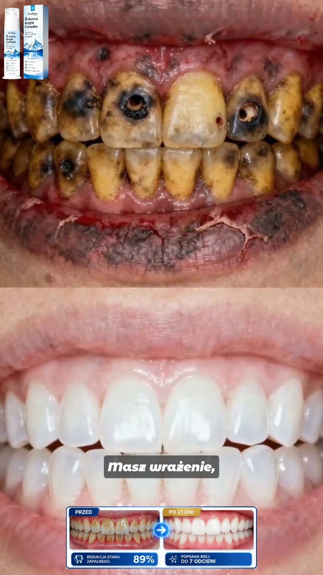 Anúncio de Elthorn-shirts