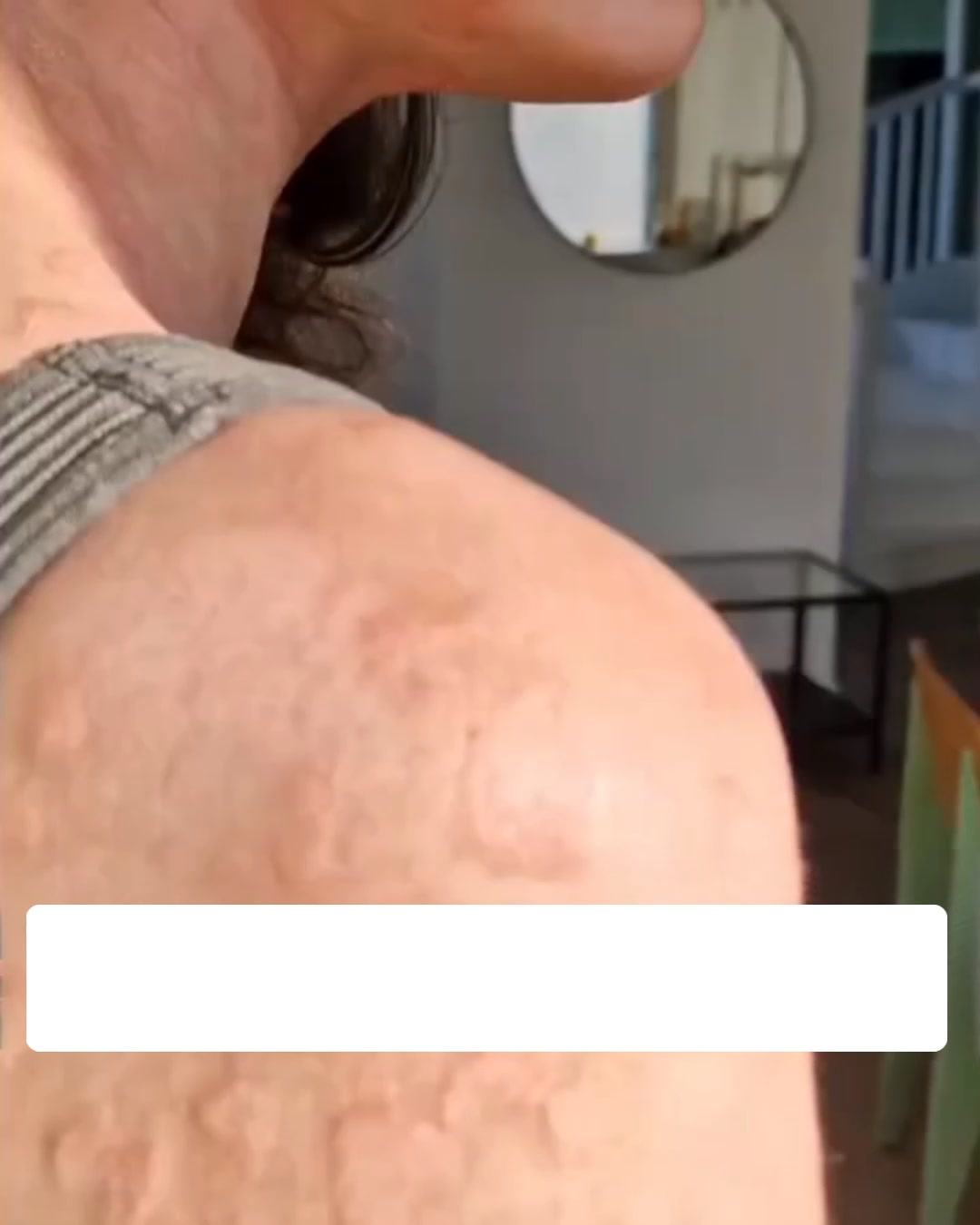 Le baume naturel qui met enfin un terme aux démangeaisons