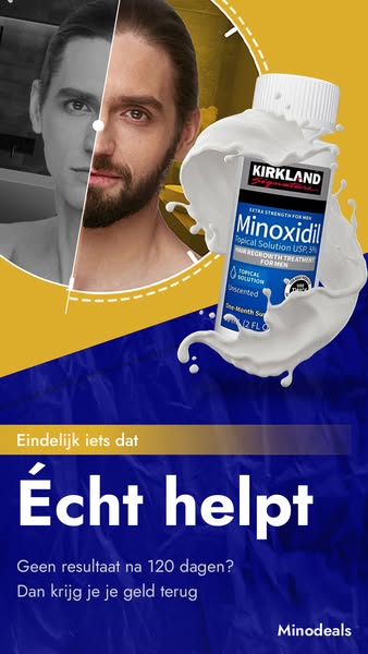 Haarverlies Of Dunner Wordend Haar?