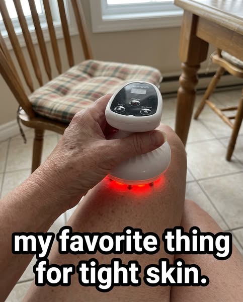 my skin is so tight