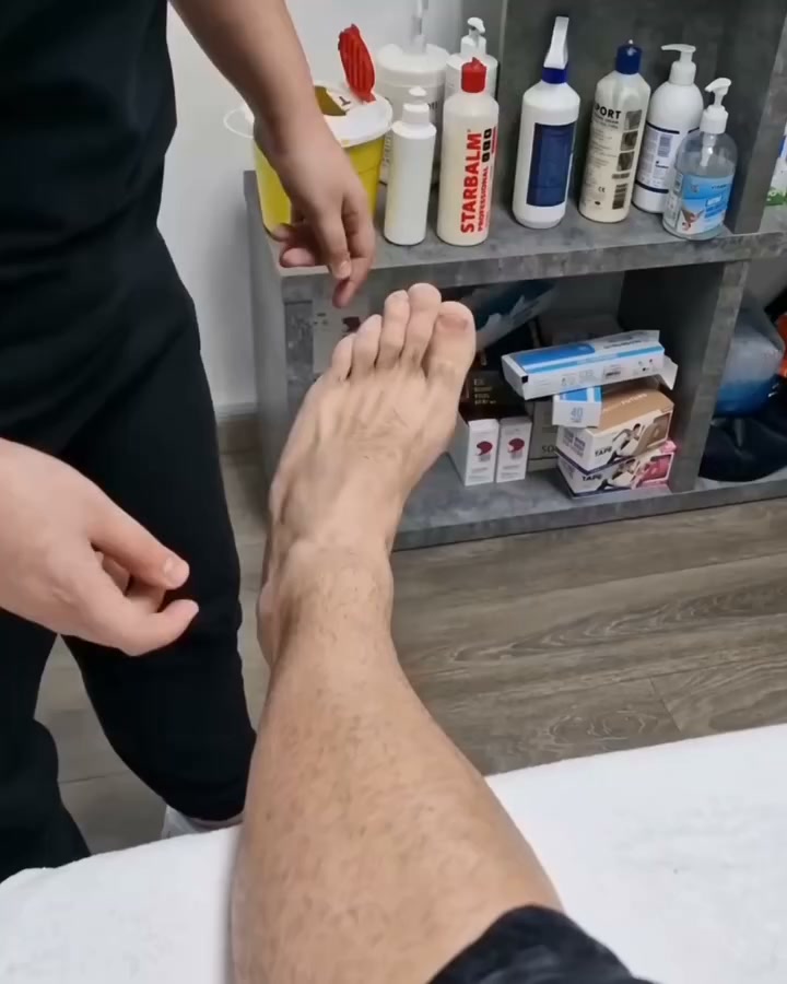 Foot Drop AFO Brace