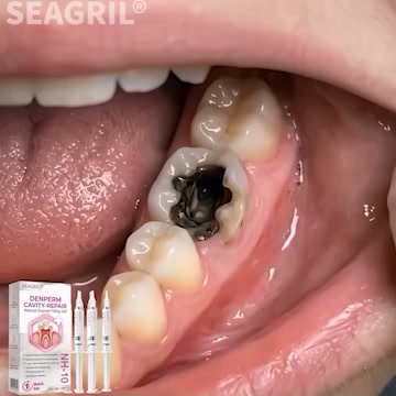 Painless Home Cavity Repair. Fast Toothache Relief!