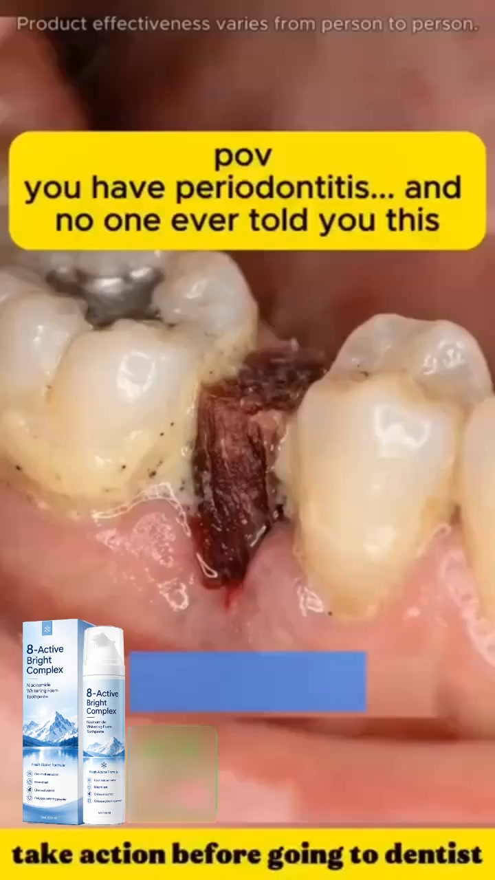 Dentist Warning: Don't Ignore Receding Gums!