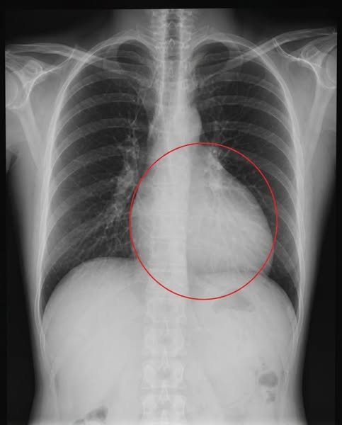 Read this if you deal with joint issues