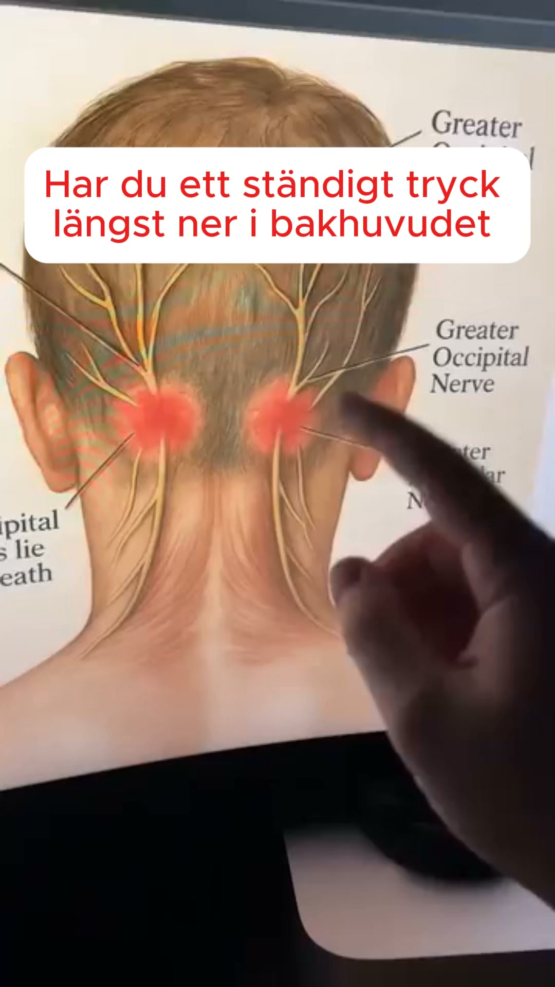 Släpp nacksmärtan på 15 minuter med CerviCare™