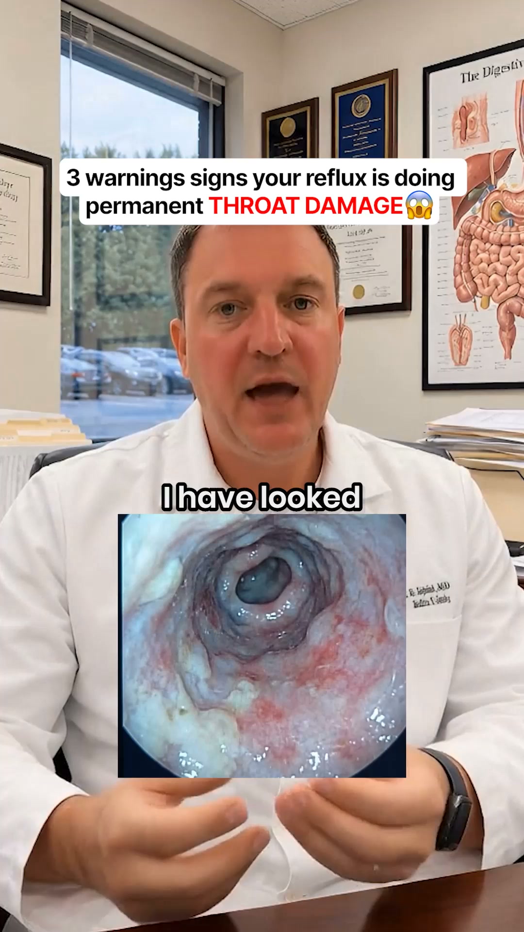 Reflux Relief Without an Acid Blocker