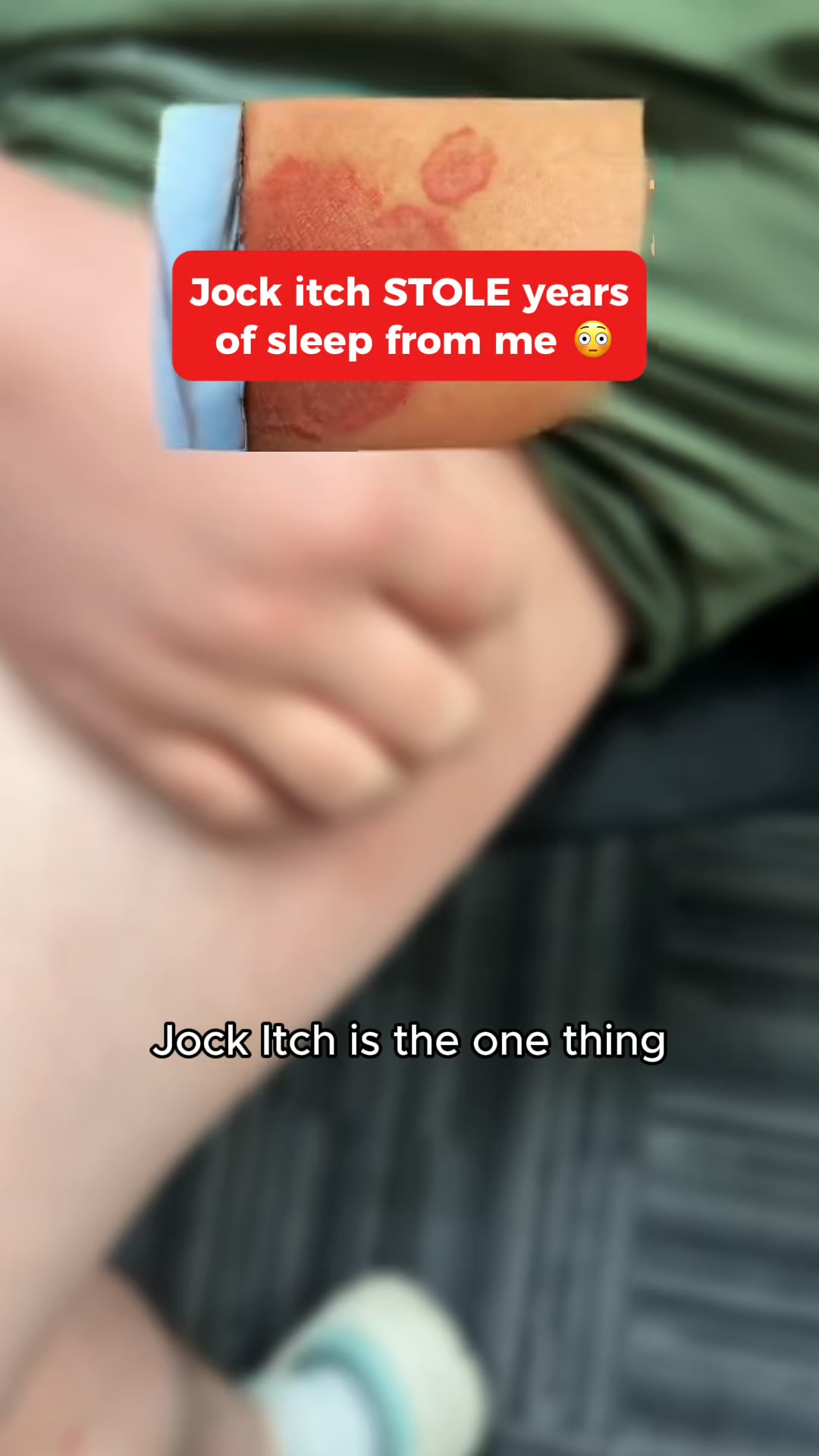 Why Your Jock Itch Keeps Coming Back