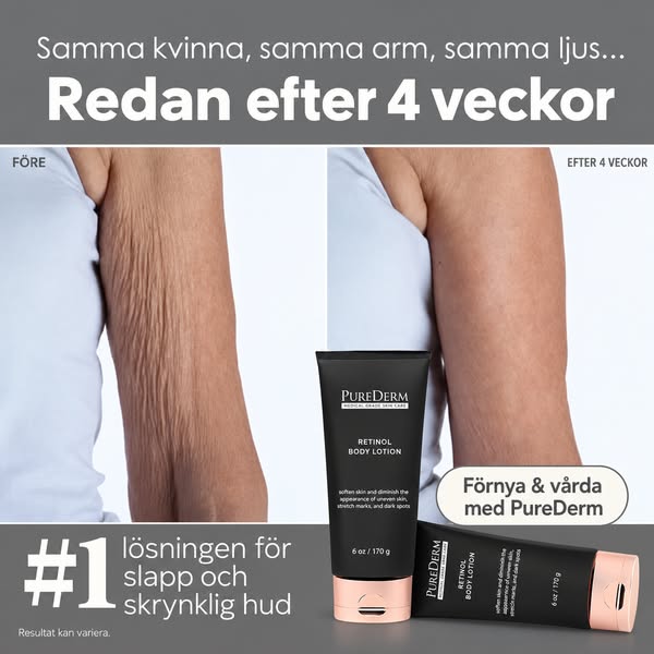 Betala senare med Klarna