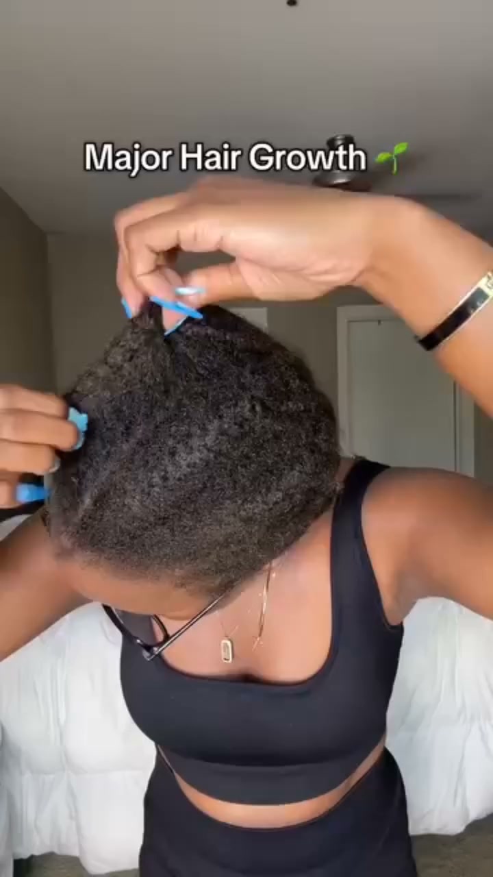 Vitamins That Will Give You Thicker & Healthier Hair