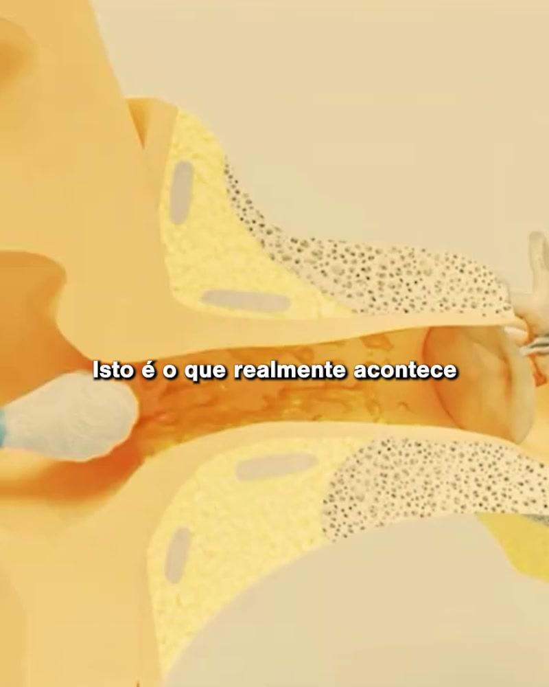 Cobrança Disponível