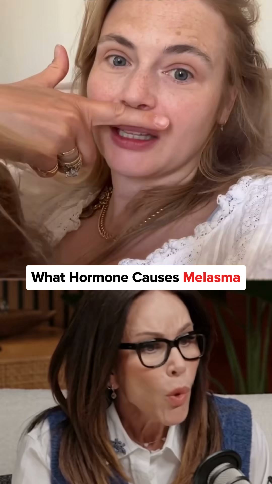 Stop Covering Melasma With Makeup, Do This Instead