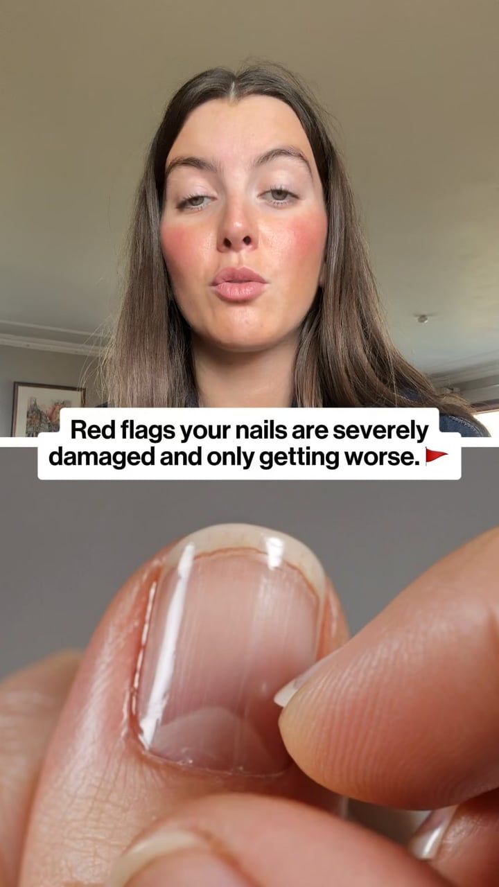 NEW way to restore your damaged nails