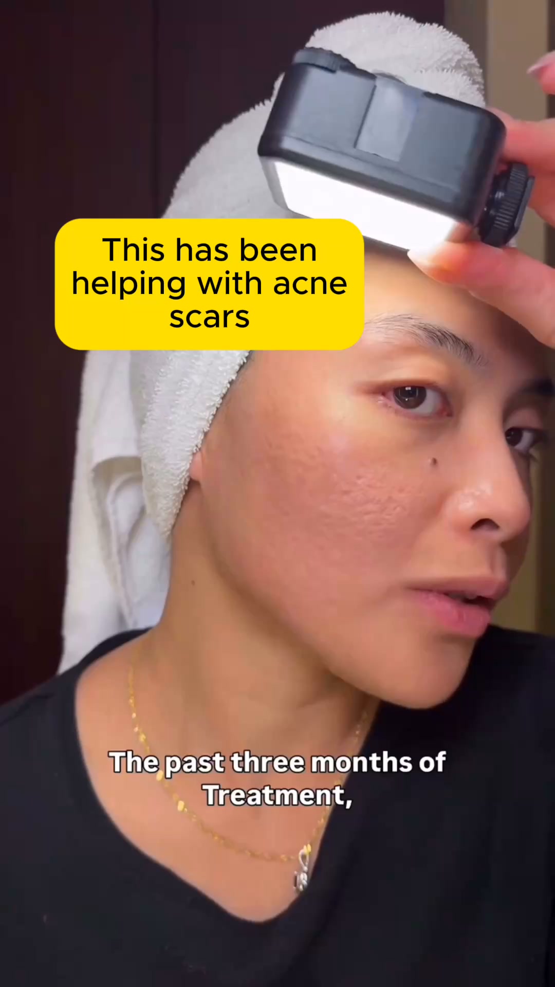 Effective Way To Smooth Out Skin Texture