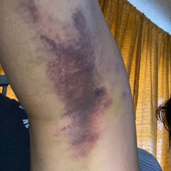 She did everything right. Her liver failed anyway.