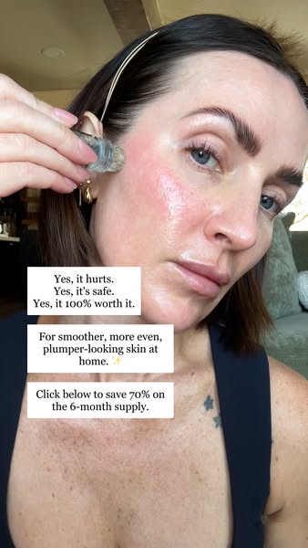 My 2026 goal: feel confident in my skin
