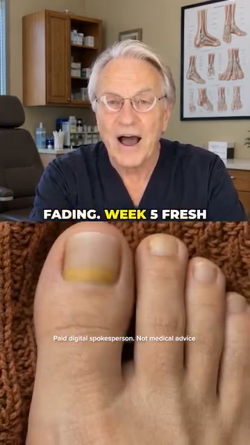 The Real Reason You’re Hiding Feet