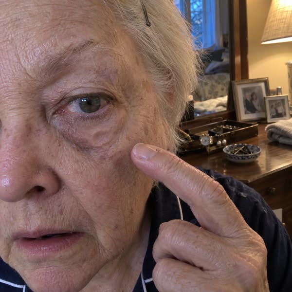 I found the reason why your under-eye bags won't go away...