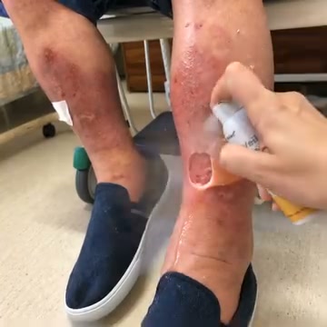 Delikatna formuła bez substancji zapachowych Testowany dermatologicznie