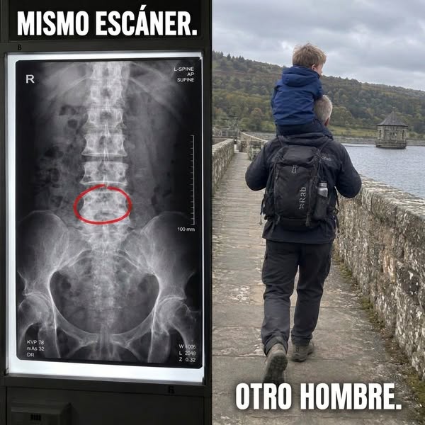 ¿Se puede tratar la ciática tan rápido?