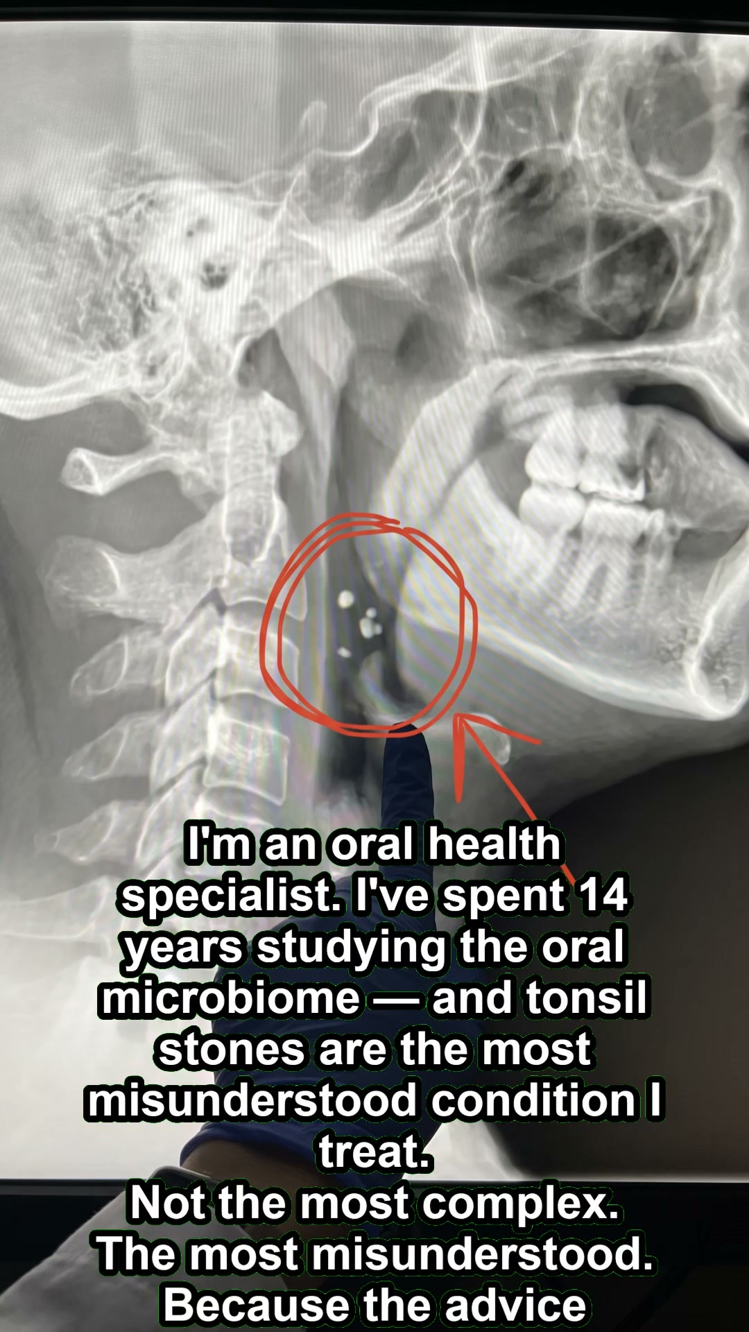 If your bad breath is constant all day, it's not coming from your mouth