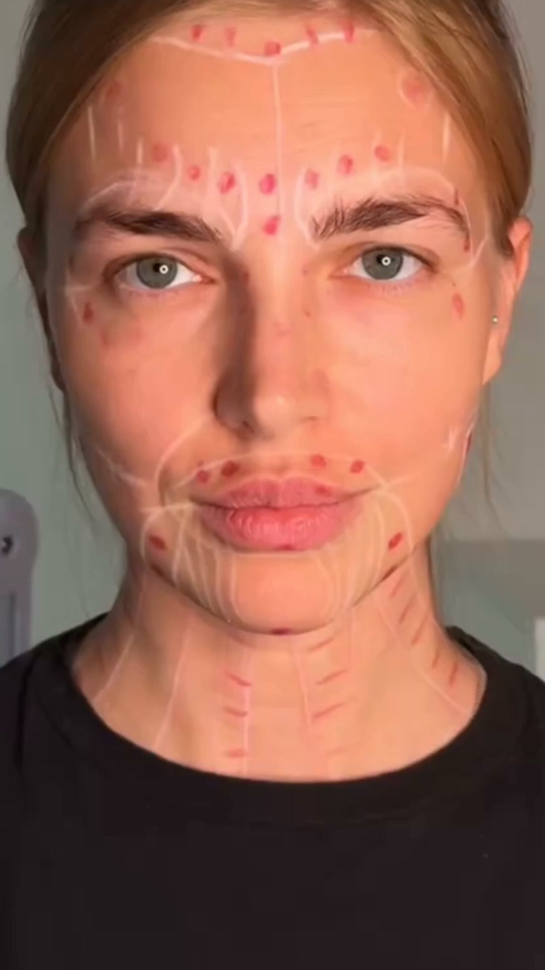 MASTER BOTULINUM TOXIN