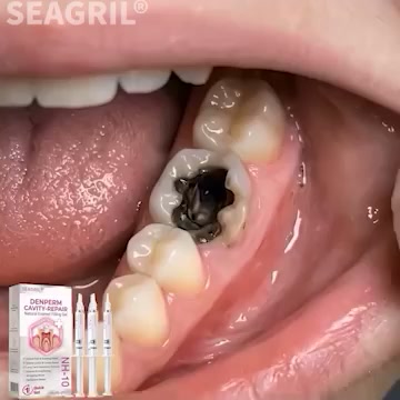 Cavity Repair FDA-Recognized 10% Nano-Hydroxyapatite (NH-10) | Delivery within 2-4 working days | Full refund guarantee