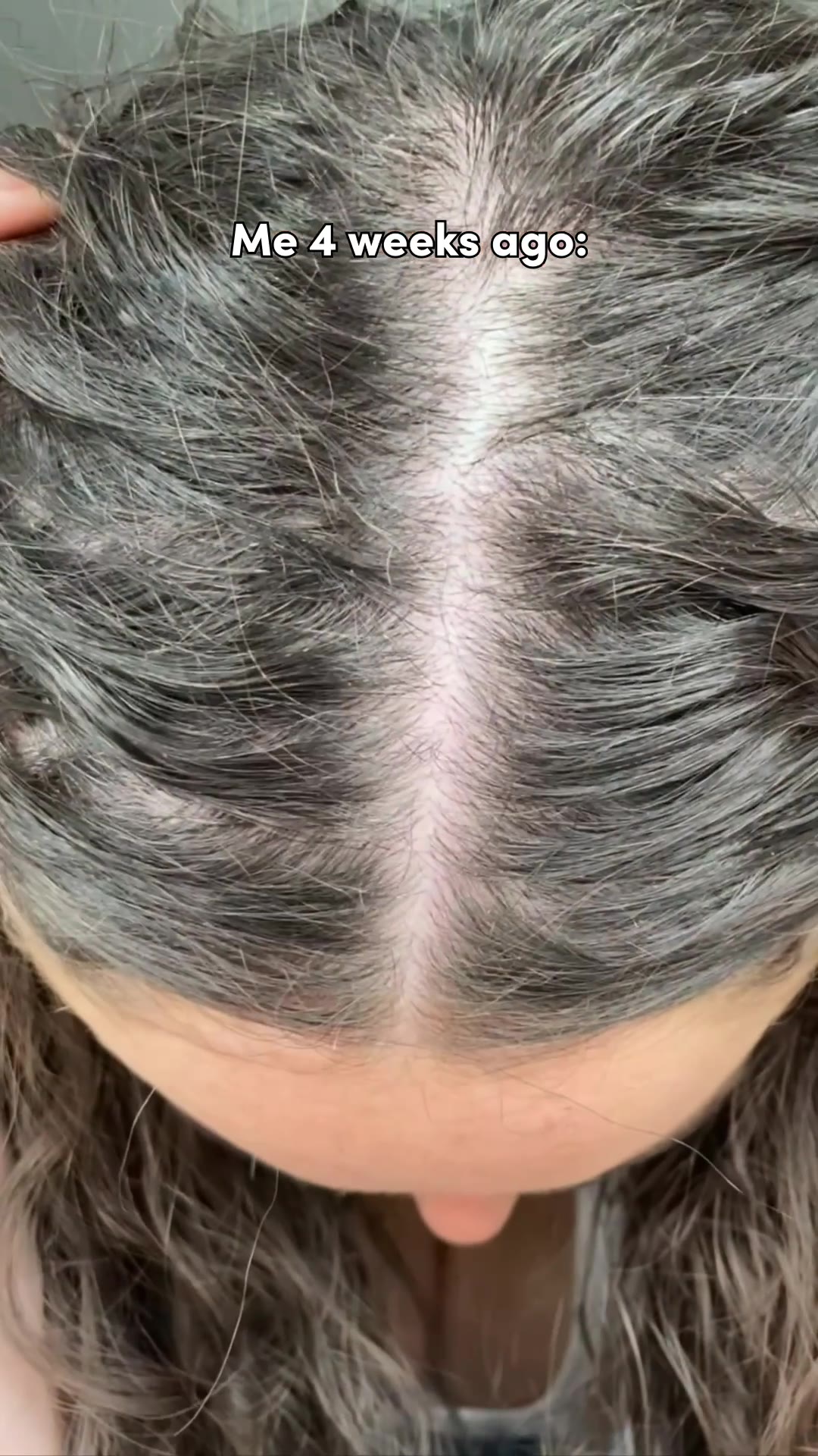 Clinically Proven To Visibly Thicken Hair
