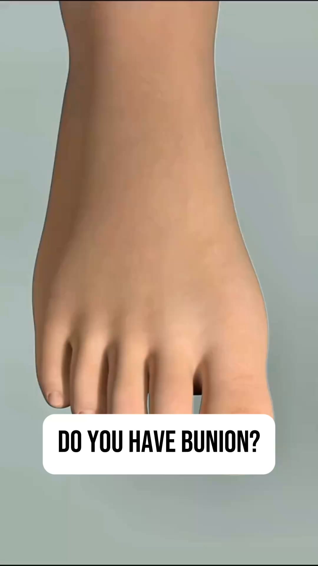 No More Bulky Plastic Braces In Your Shoes