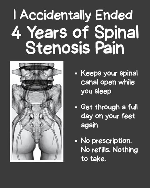 More Details About Spine Alignment Here