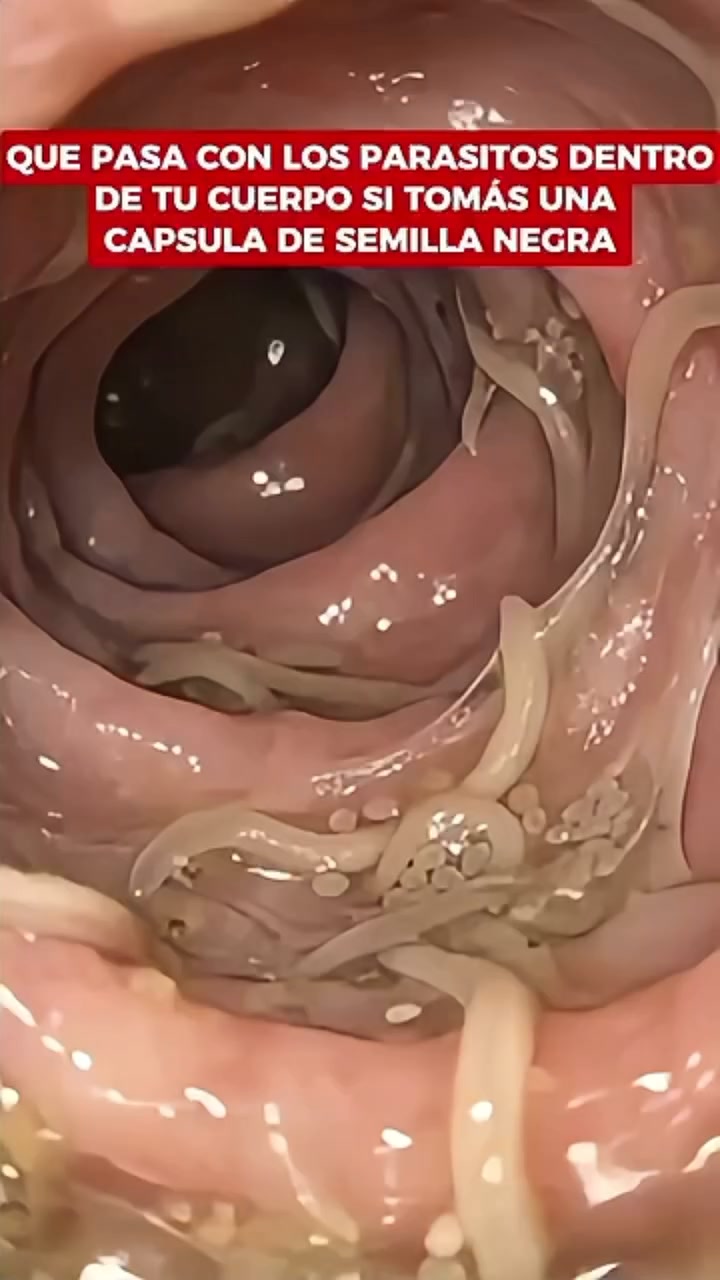 El aceite de semilla negra 10 veces más potente que tu cuerpo necesita