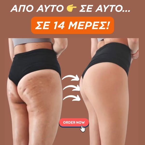 Cellulite Reducing Body Cream 200 ml