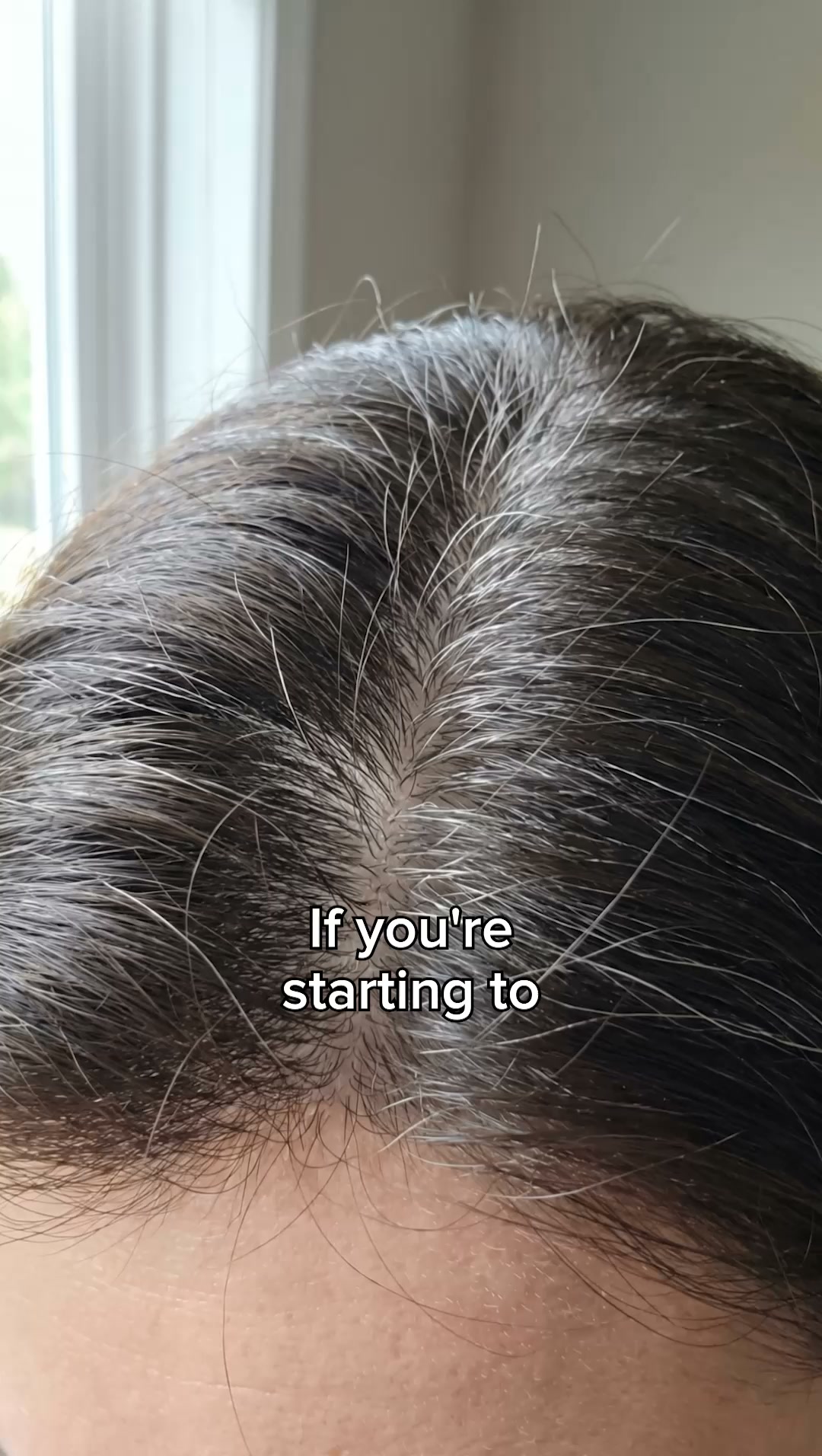 Don't Wan't Gray Hair Yet??