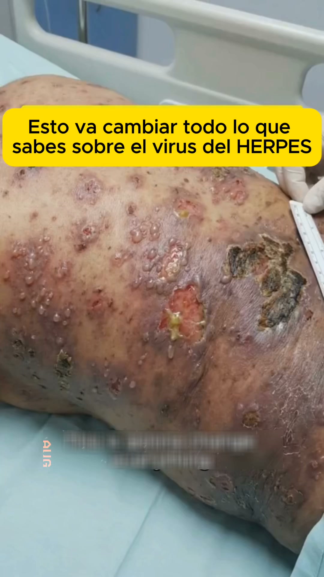 Anúncio de Vitacarga