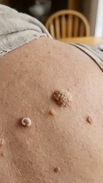 Anúncio de Sumiol Fit